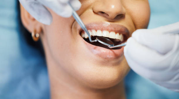 Best Emergency Treatment for Dental Infections or Abscesses in Washington Park, FL