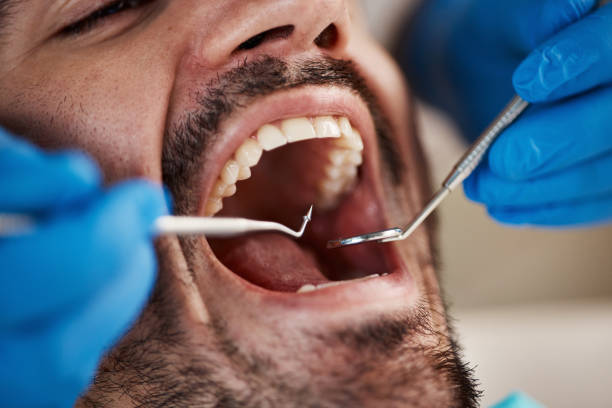 Best Emergency Treatment for Dental Infections or Abscesses in Washington Park, FL