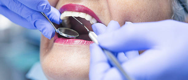 Best Emergency Dental Care for Broken or Chipped Teeth in Washington Park, FL